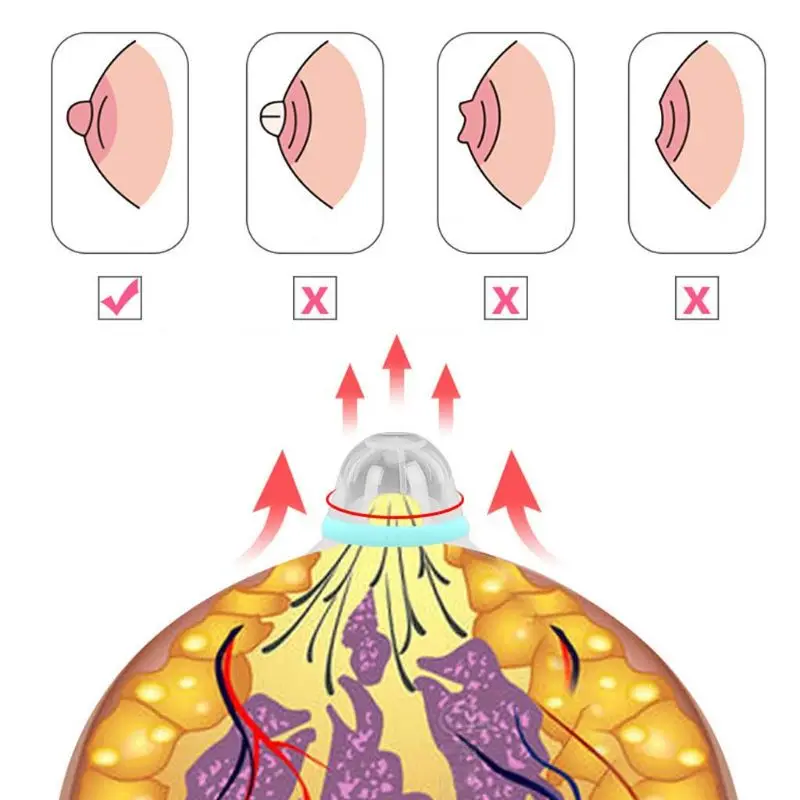 Extractor o extensor pezones para pezones planos, tímidos o invertidos.