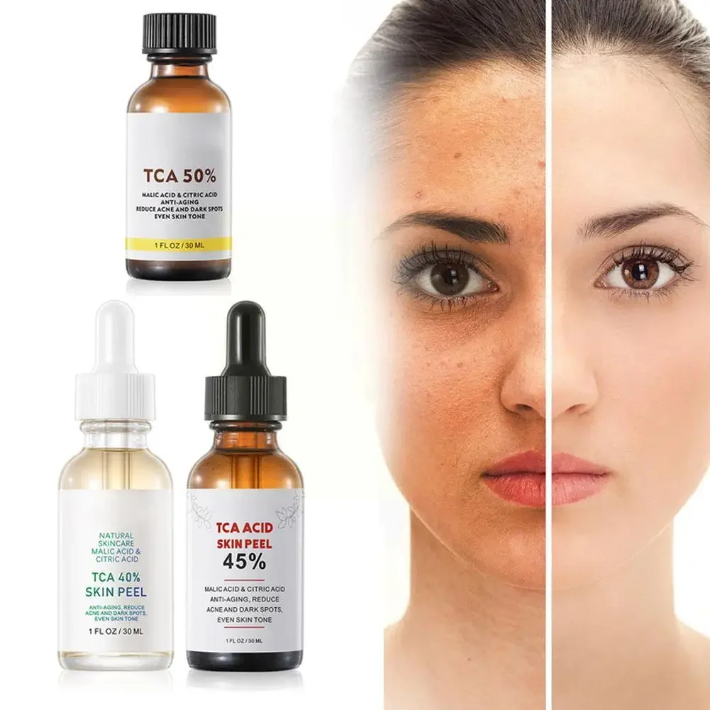 

30ml 40% 45% 50% Peel Acid Skin Peel Peeling Acid Aid Serum Skin Acid Skin Peel 20% Trichloroaectic Serum Wrinkles