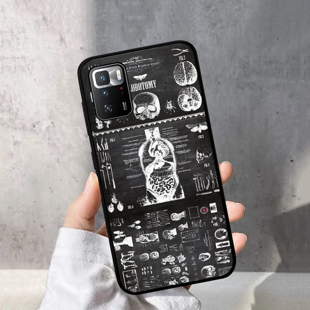 Human Organs Skeleton Skull Phone Case For Redmi Note 4 X 5 A 6 7 8 Pro T 9 Pro 9S 10 Pro 11 Pro 11S 11Epro PocoM3pro