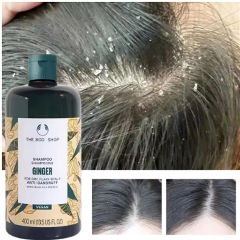 

400 мл натуральный имбирный шампунь для блестящего ухода за перхотой, нежно удаляет хлопья, успокаивает сухую, зуд кожи головы, веганская формула, чувствительная кожа головы