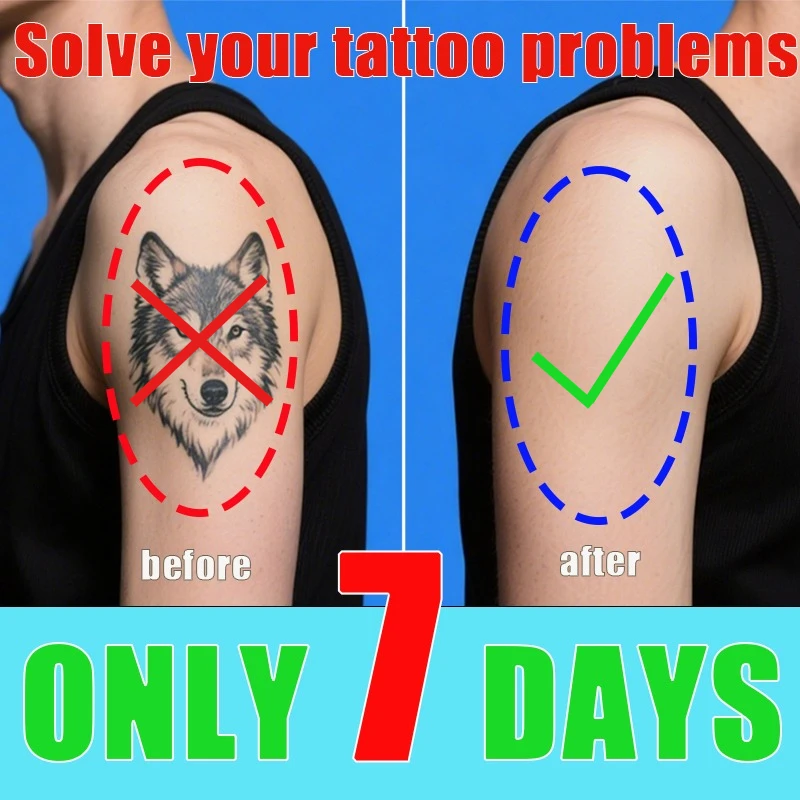 

Спрей для удаления татуировок эффективно удаляет перманентные татуировки