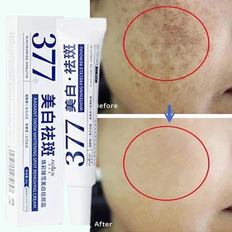 

Whitening Freckle Cream Melasma Dark Spots Pigmentation Removal Products Fade Stain Melanin Repair Brighten Korean Skin Care