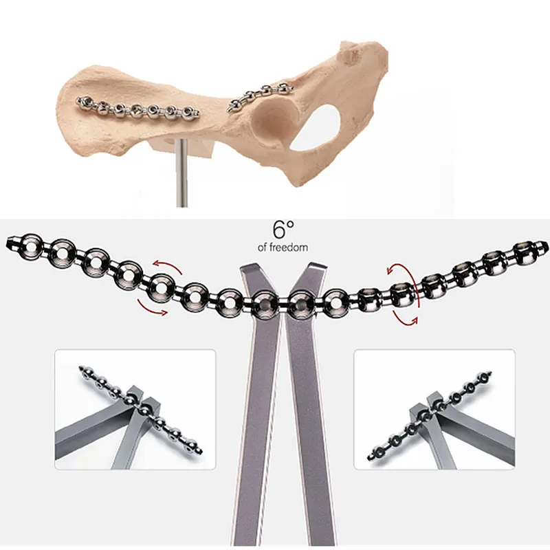 

Veterinary Animal Trauma Veterinary s Stainless Steel Strong SOP Interlocking Locking Sop Plate