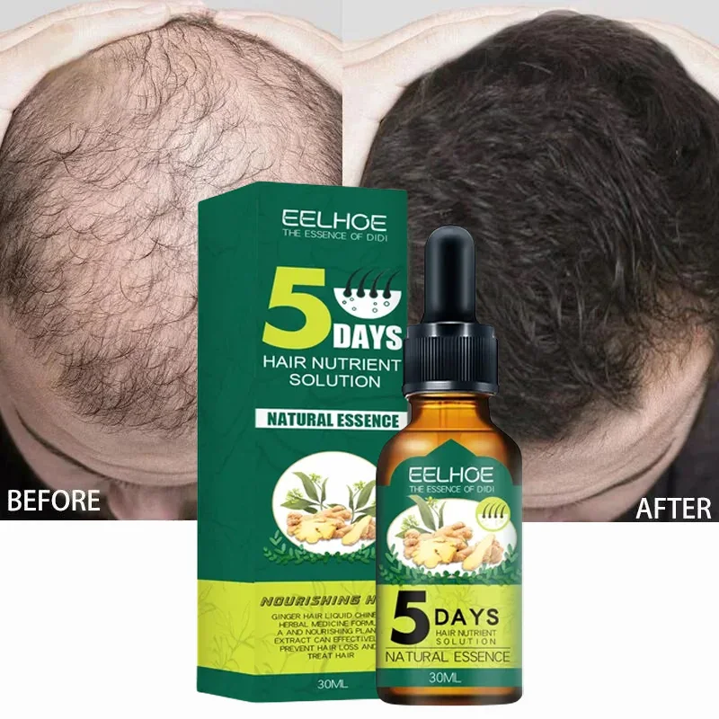 Essentiall Oil Hair Growth Products Organic Hair Products Scalp Hair Strengthening Oil For Nourish Shiny Hair Healthy 2024