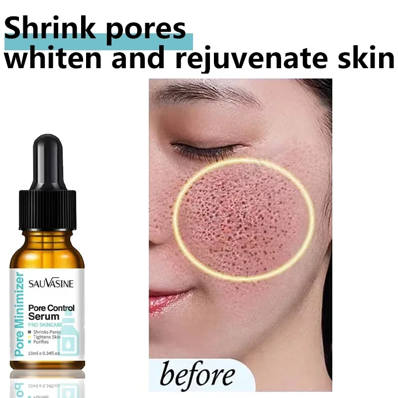 

Anti Acne Exfoliating Face Serum Peeling Solution Pore Shrinking Serum Oil-Control Firming Moisturizing Repairing Smooth