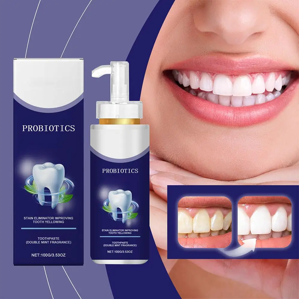 O creme dental probiótico para limpeza dos dentes, 100g, pode remover efetivamente manchas dos dentes e refrescar o hálito, produto de cuidados bucais