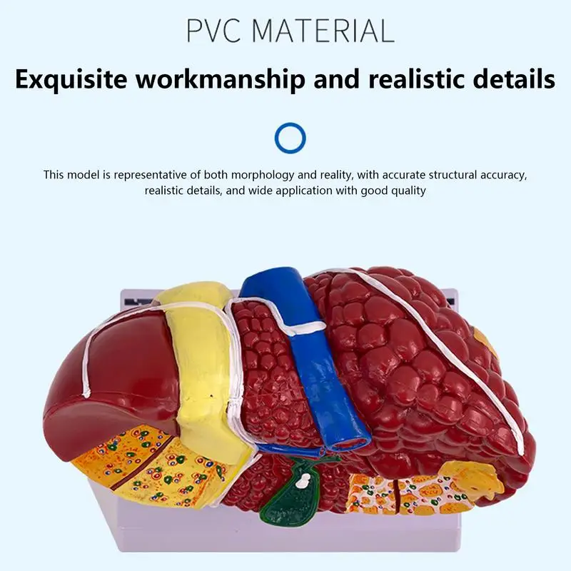 โมเดลตับมนุษย์พยาธิวิทยากายวิภาคที่มีพื้นผิวที่ชัดเจนสำหรับการสอนการแสดงตับรูปแบบอเนกประสงค์