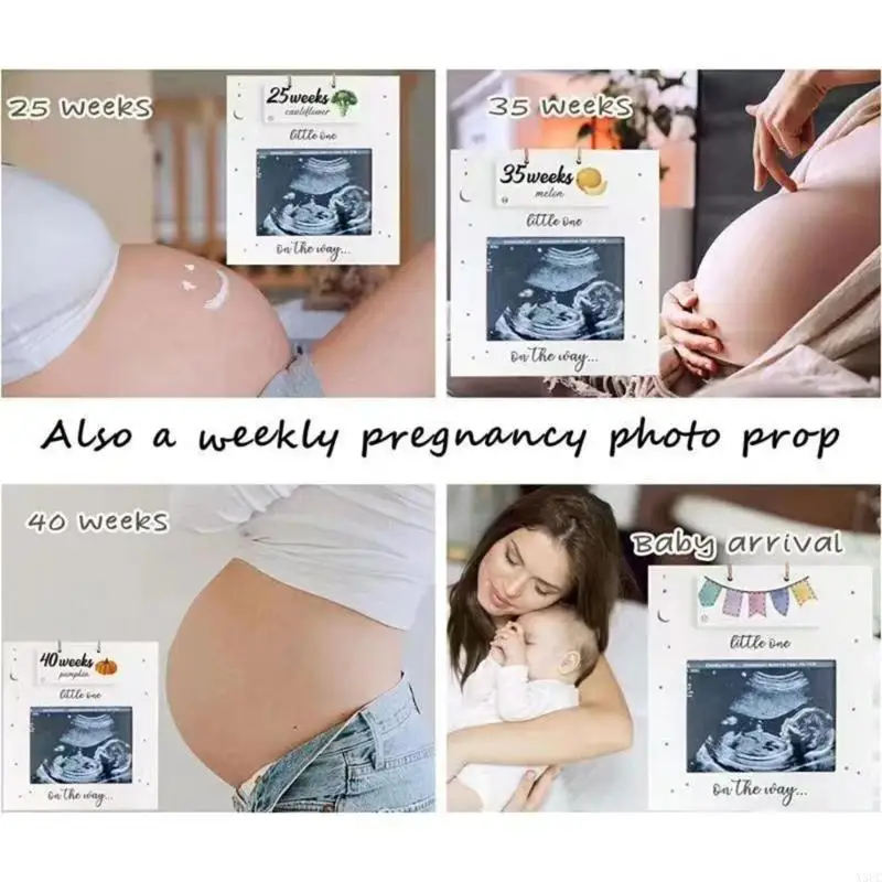 Sonogram Picture Frame Pregnancy Gift Baby Announcement Keepsakes For Couple X3UC