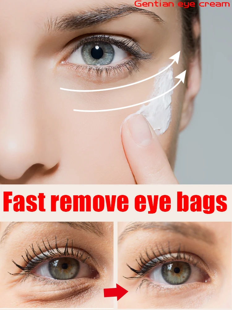 

Eye bag cream