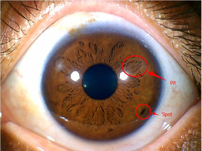 نظام Win10 مناسب لكاميرا Iidology للعين بدقة 12.00 ميجابكسل