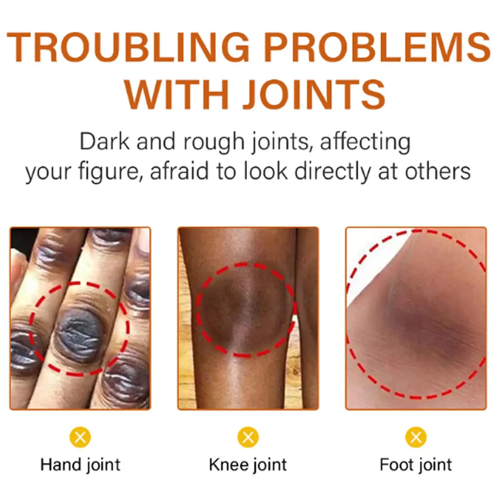 صابون تبييض الجسم تحت الإبط صابون تبييض الركبة إزالة جلد الدجاج إزالة البقع الداكنة الجلد الميت ترطيب سطع العناية بالجسم #5