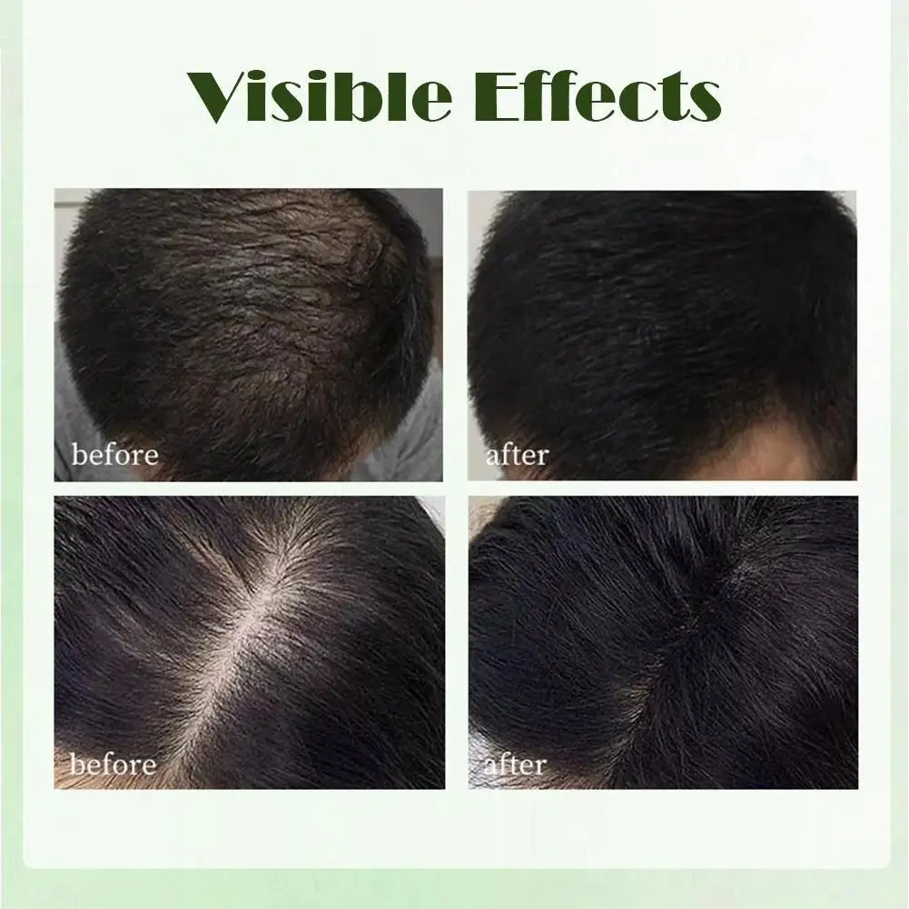 プラティクラディ ウスマン草 手作りシャンプー石鹸 イタドリ 抗脱毛 固形ヘア栄養ヘアコントロールオイル 120g