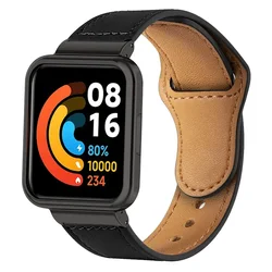 Leather Strap for Redmi Watch 2 Lite Smart Watch Band Metal Case Protector for redmi watch 2 lite Bracelets Belt bumper frame