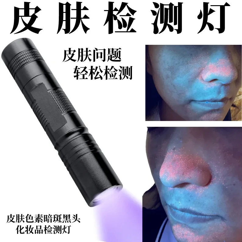 Lâmpada fluorescente do analisador da pele, iluminação facial, cravo, acne, teste do óleo, diagnóstico fungoso, cosméticos