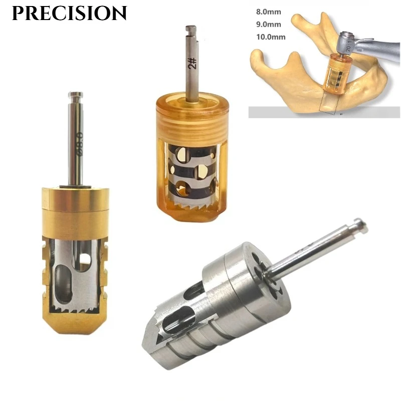 Dental GBR SLT Semilunar Bone Collector Drill Semilunar Technique Semilunar Shell Bone Argumentation Easy Bone Colloector