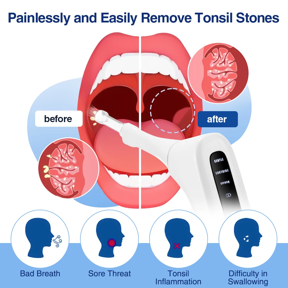 Electric Tonsil Stone Remover Tool 3 Suction Modes Built-in LED Light address bad breath Oral Fresh Care Tonsil Cleane Tool