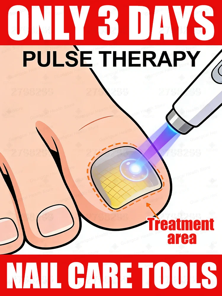 

2025 new Free shipping, Christ Blue light laser pen ᵗʰᵒʳᵒᵘᵍʰˡʸ ʳᵉᵐᵒᵛᵉˢ ᶠᵘⁿᵍⁱ⸴ ᑫᵘⁱᶜᵏˡʸ ᵉˡⁱᵐⁱⁿᵃᵗᵉˢ ᶠᵘⁿᵍⁱ⸴and restores nail health.