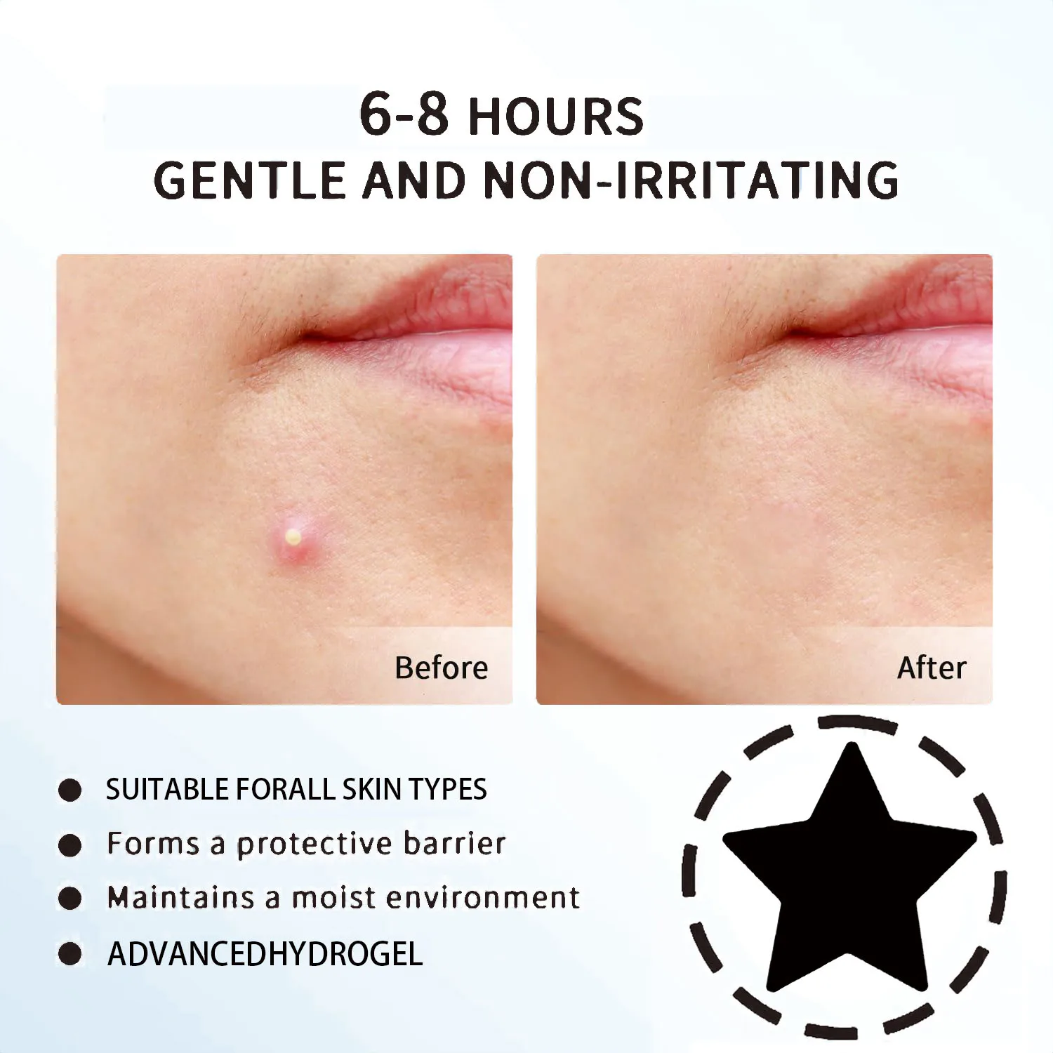 رقعة حب الشباب الغروانية المائية غير المرئية المقاومة للماء لتنظيف الوجه، ملحقات أداة جوهر مناسبة لجميع أنواع البشرة #3