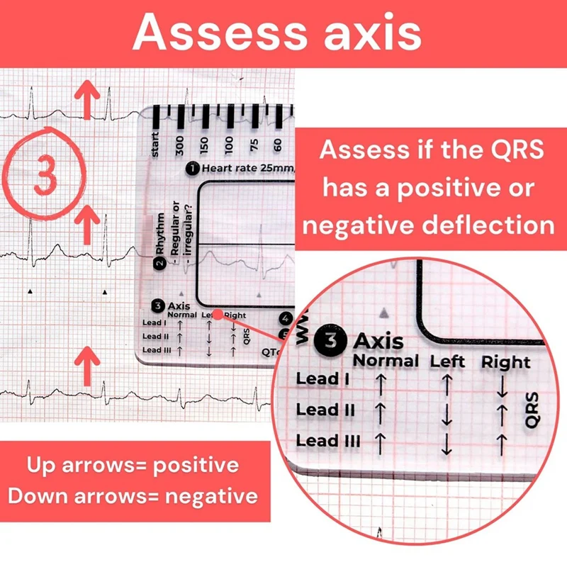ECG 7 Step Ruler, ECG 7 Step Ruler for ECG/EKG Interpretation, Rapid and Quick Cardiac Analysis and Measurement Tool