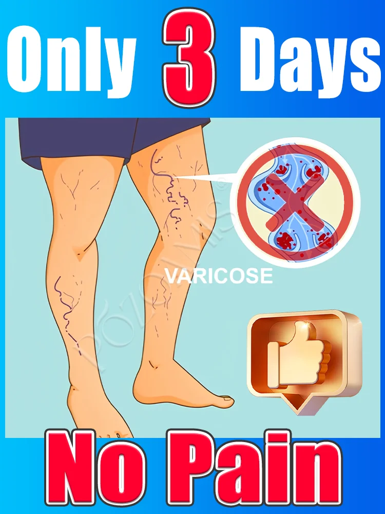 Hot-selling producten in 2025: Massagehulpmiddelen, verlichtingsproducten voor beensproeven