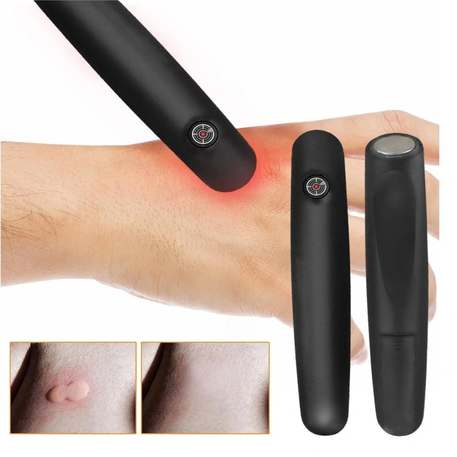 Itch Relief Stick Portable Black Anti-Itch Therminator PenFast Symptom Relief Reduce Pain & Itching No Odor or Residue