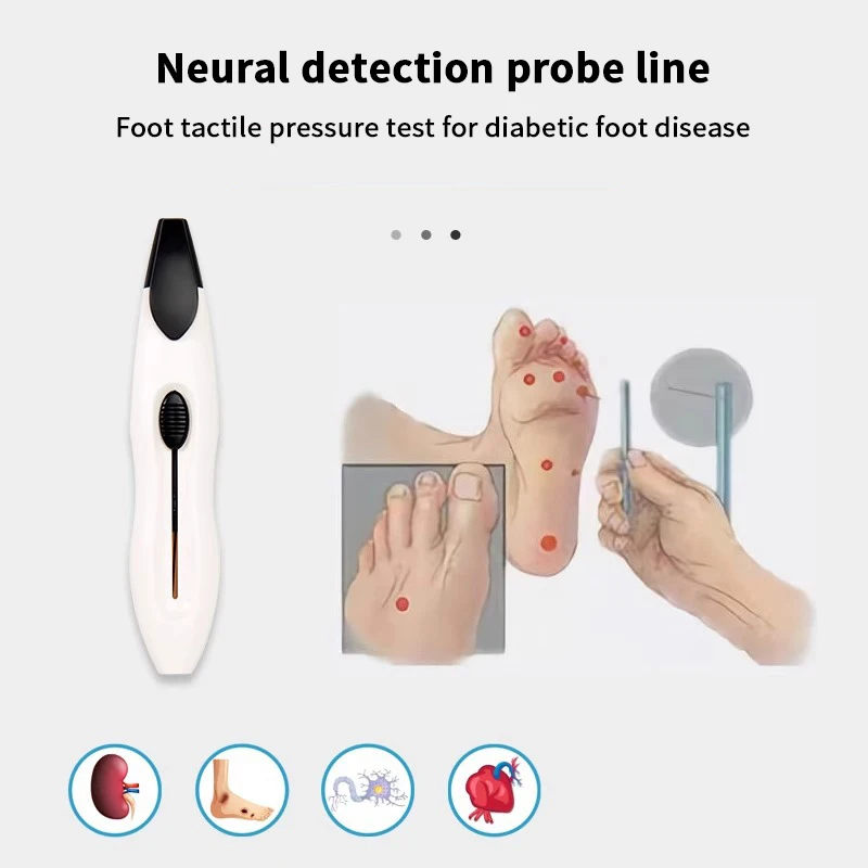 Medical 10g Nylon Diabetic Monofilament Sensory Tester Skin Foot Nerve Needle Pen Endocrinological Neurological Diagnostic Pen