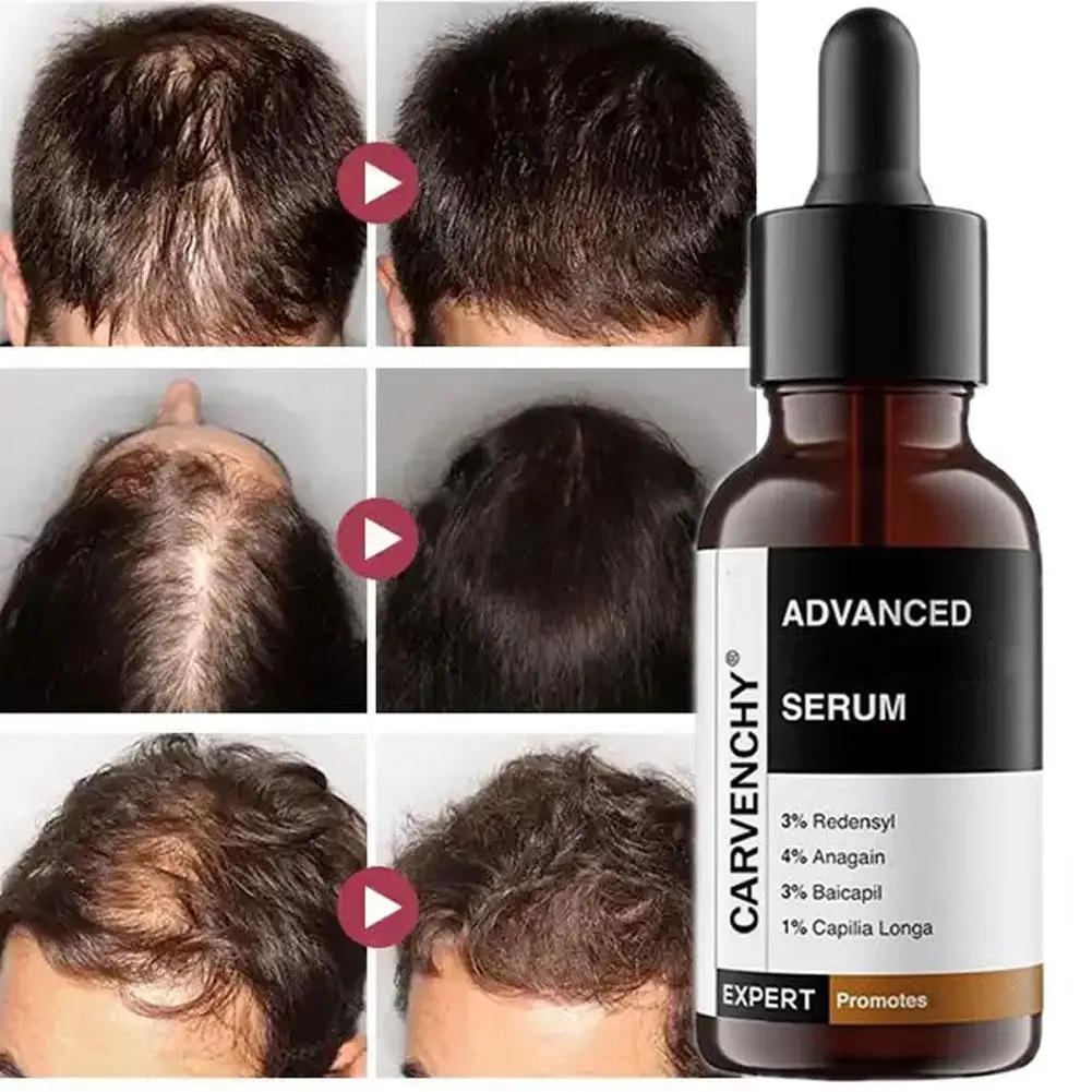 

Rosemary Superior Hair Growth For Men And Women Essence Advanced Hair Serum Anti Hair Loss Hair Care Liquid 30ml