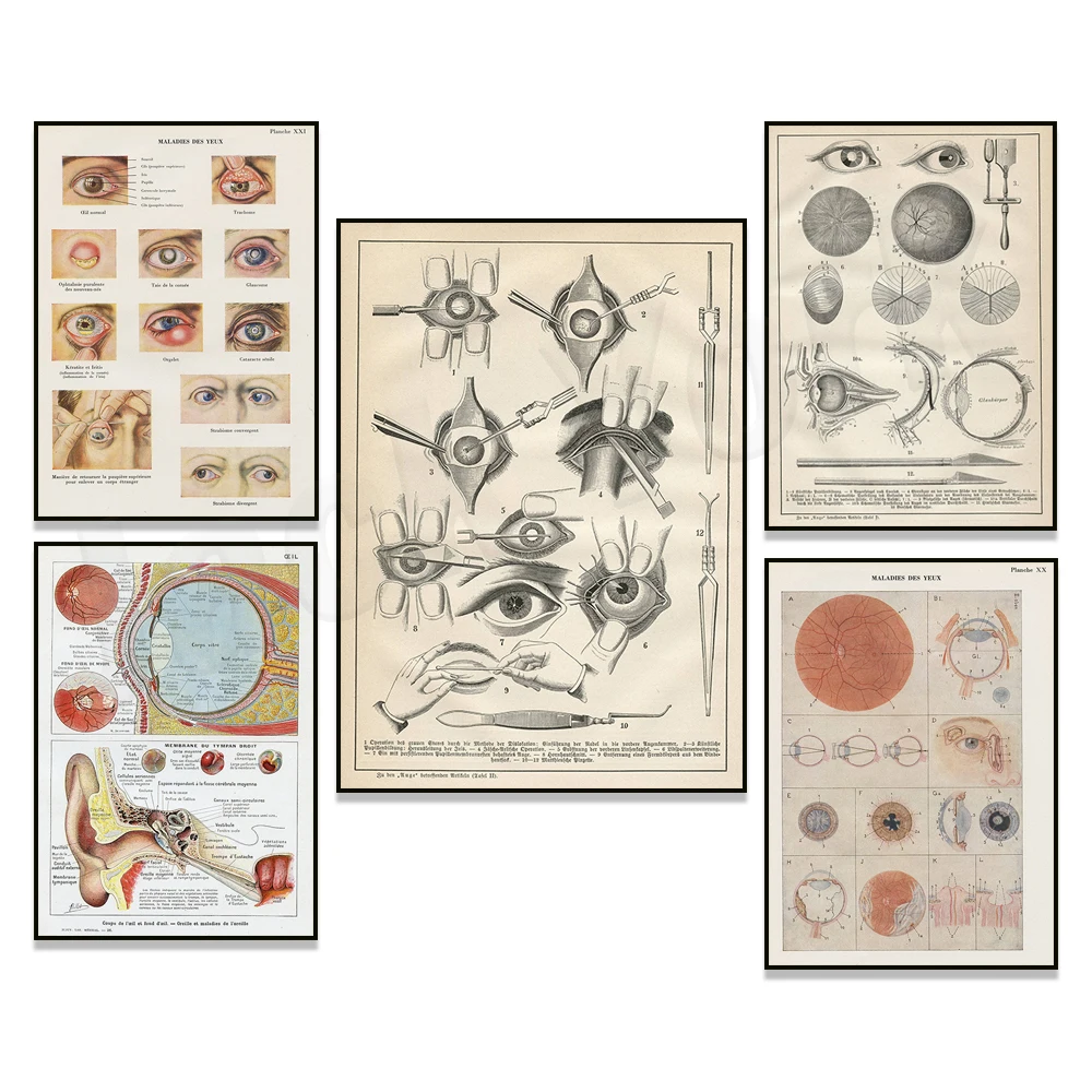 (2D Canvas Painting)  Eye anatomy, eye + ear medical anatomy, antique french medical illustration of an ophthalmologist, vint