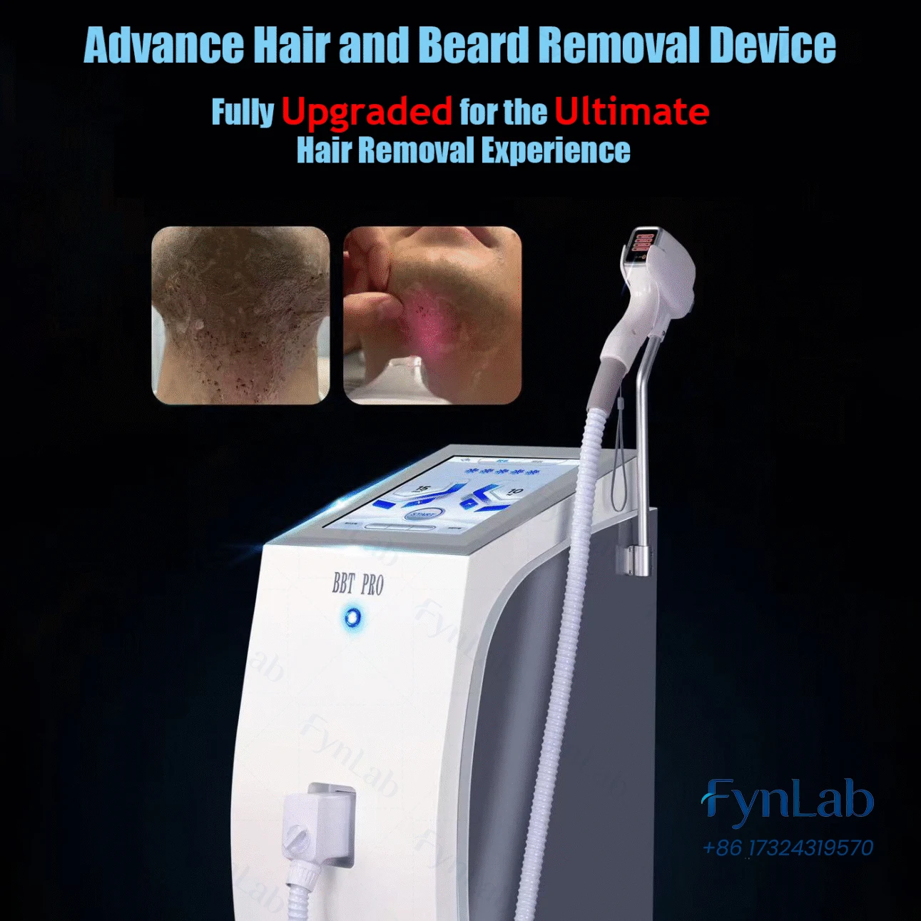 Professional 2400W Diode Laser Beard Hair Reduction Beauty Machine 14×14mm Sapphire Cooling Handle 1–10Hz 50M Shots Salon Use
