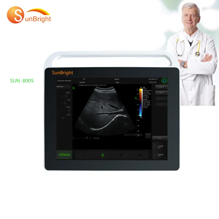 portable echocardiography machine/doppler color ultrasonido equipo/ecografo