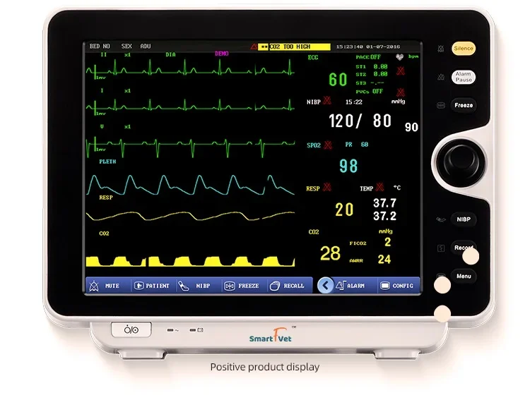 Smart F Vet Veterinary Vet Multi-parameter Patient moni tor Veterinary Multir 6 Patient moni tor for Vet Clinic use e cg moni to