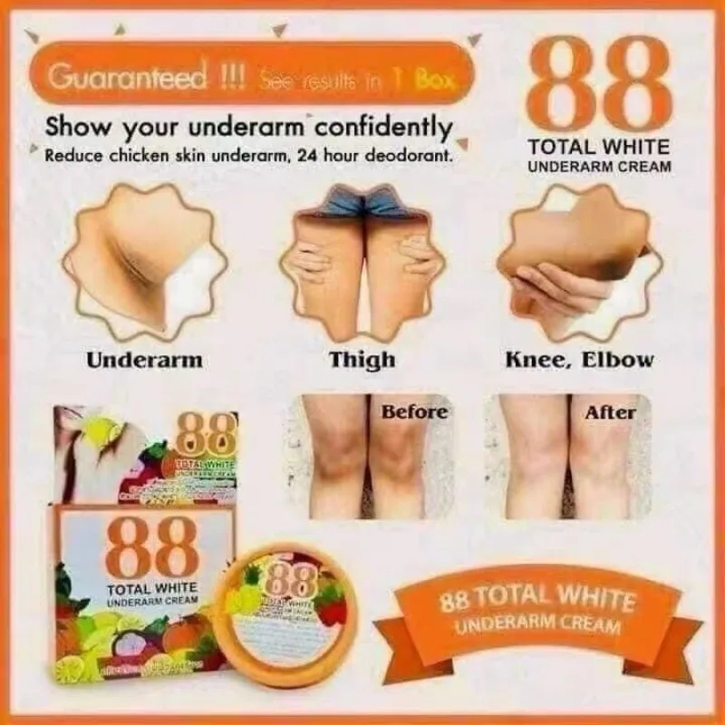 Total White Underarm Cream for Knees Elbows Armpits, Brightening Body Lotion for Dark Spots