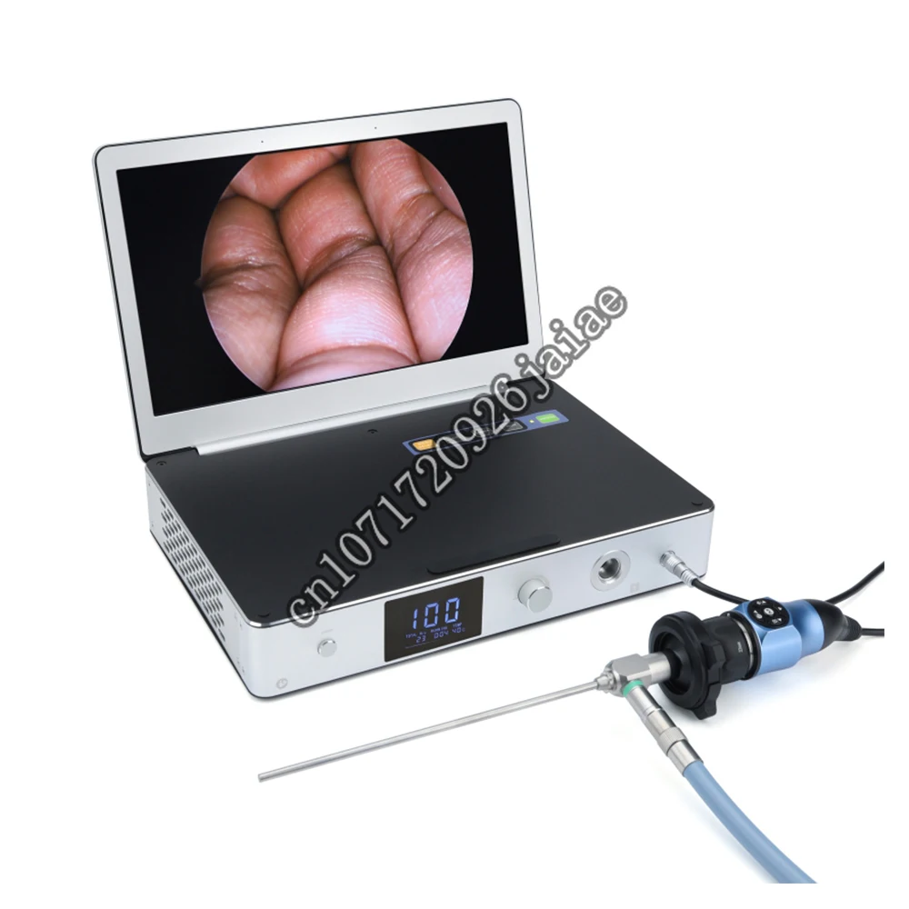 

Camjoy Medical CMOS portable endoscopy video HD for Orthopedics