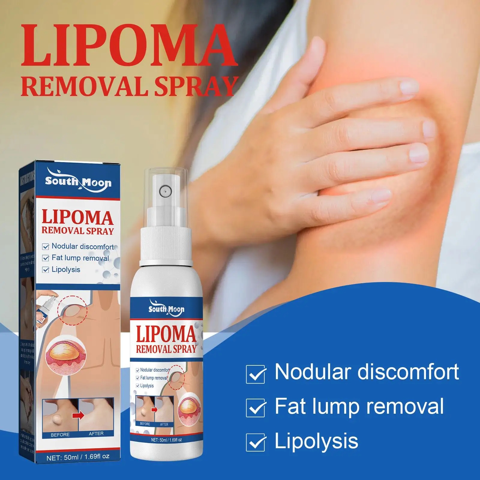 Lipoma Removal Spray Pain Treatment For Skin Swelling Fat Soluble Cellulite Fat Nodule Removal Cream Anti-tumor 50ml