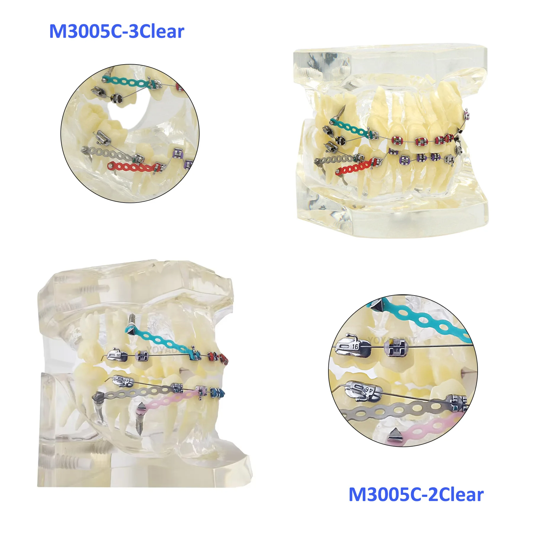 

Dental Teeth Model Orthodontic Treatment Model Demonstration Model For Study Teaching Dentist Ortho Model