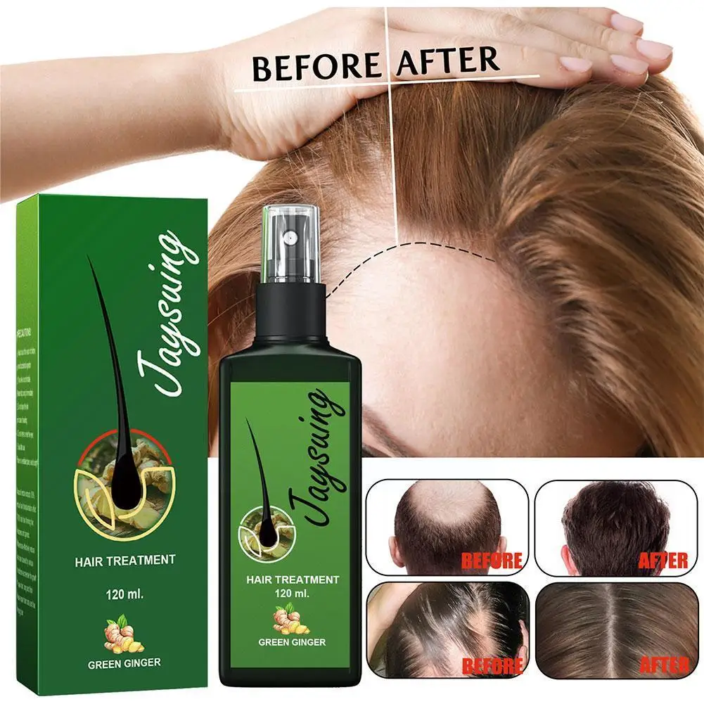 120ml Serum Ginger Extract Anti Hair Loss Hair Dry Fast Thinning Repair Growth Treatment Hair Products Spray Pr I4F1