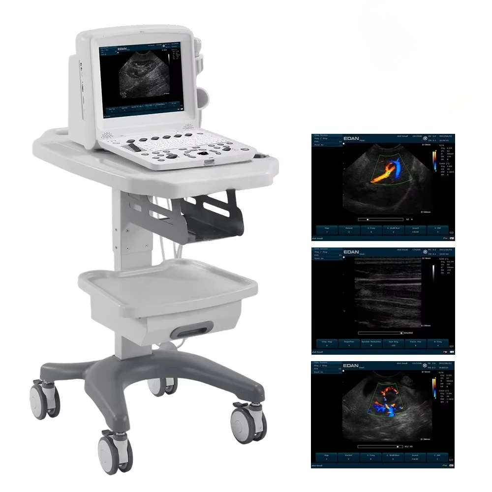 Edan U50 VET Veterinary Medical Equipment, Ultrasound Machine for Animal Image Scanning, Dogs, Cats, Pets, and Animal Diagnostic