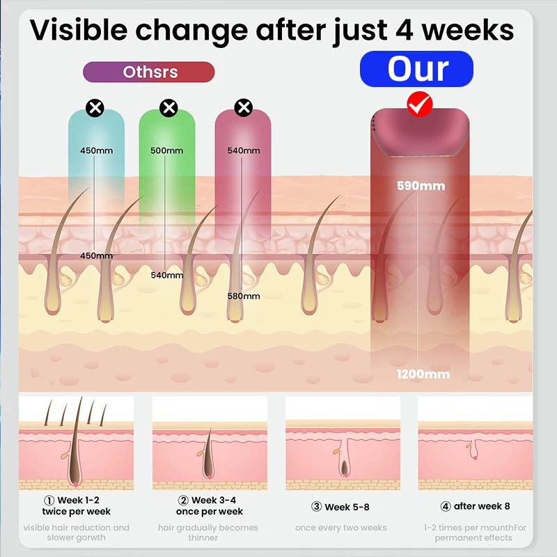 إزالة الشعر بالليزر Bosidin للنساء ، نظام تبريد الثلج ، مزيل الشعر Ipl ، الاستخدام المنزلي ، الحلاقة والإزالة ، فلاش غير محدود
