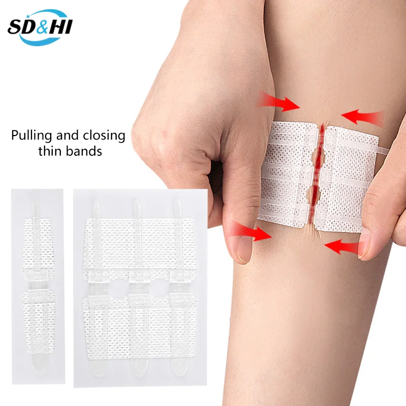 1 Stuks Rits Band Wond Sluiting Patch Rits Pleister Wond Snelle Hechting Buiten Draagbare Hemostatische Patch EHBO-Tool