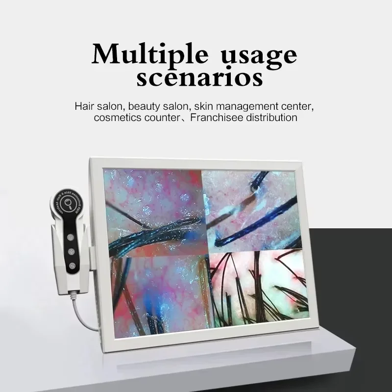 

15-дюймовый HD-дисплей 50/200X профессиональный детектор фолликулов для волос, диагностическая машина для кожи головы, анализатор кожи, тестер влажности и кожи