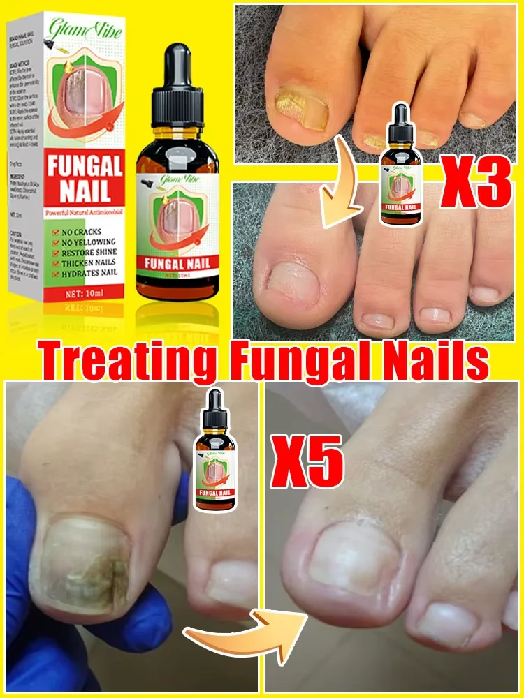 Sᴜᴍᴍᴇʀ's sᴇᴄʀᴇᴛ ᴡᴇᴀᴘᴏɴ ᴍᴀᴋᴇs ʏᴏᴜʀ ғᴇᴇᴛ ʙᴇᴀᴜᴛɪғᴜʟ ᴀɴᴅ ʏᴏᴜʀ ᴛʀᴏᴜʙʟᴇs ᴅɪsᴀᴘ