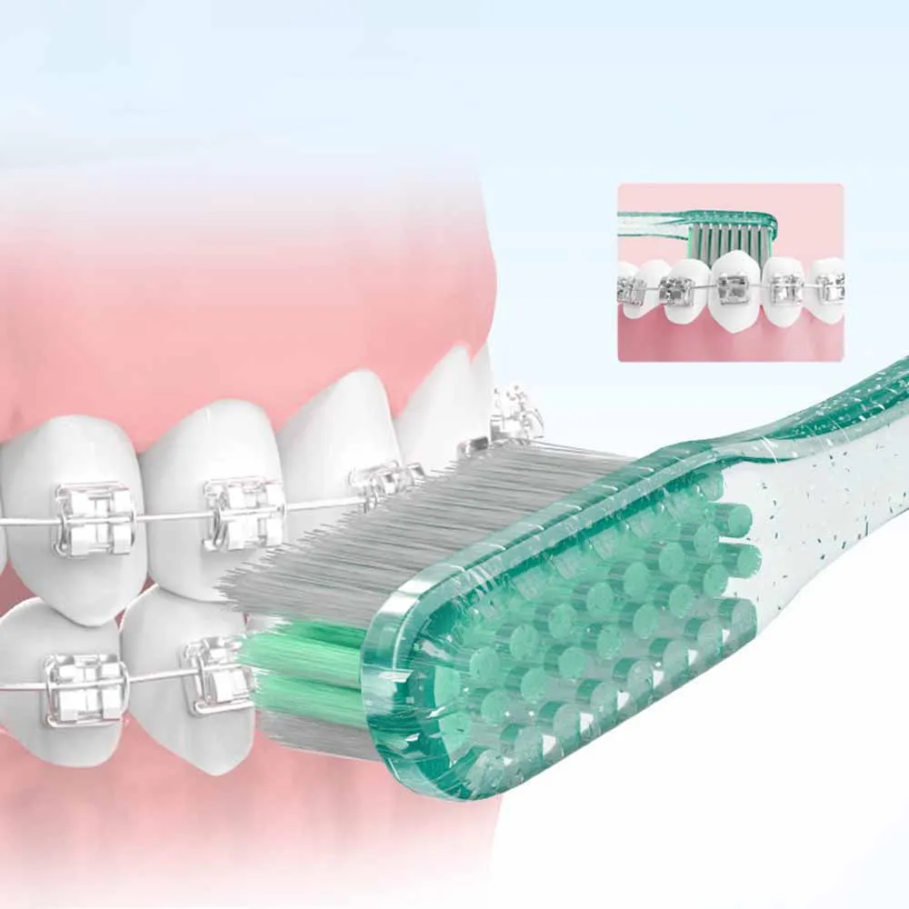 Super Deer Orthodontic Toothbrush With Interdental Brush L/U Shape Design Brace Toothbrush Orthodontic Cleaning Supplies