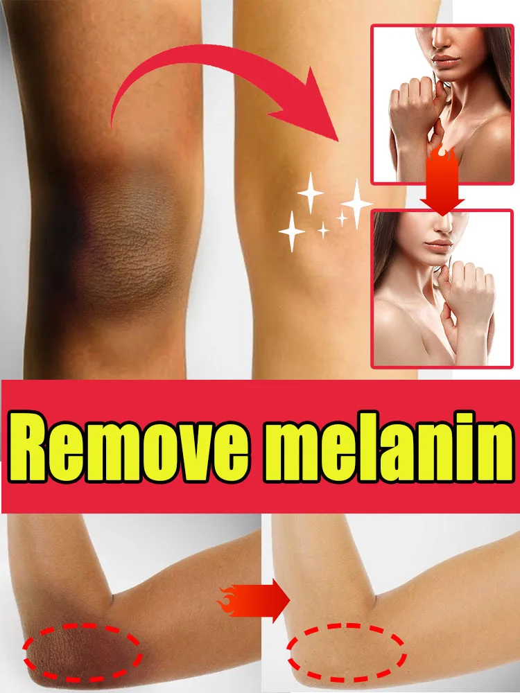 Moisturize skin and get rid of skin troubles