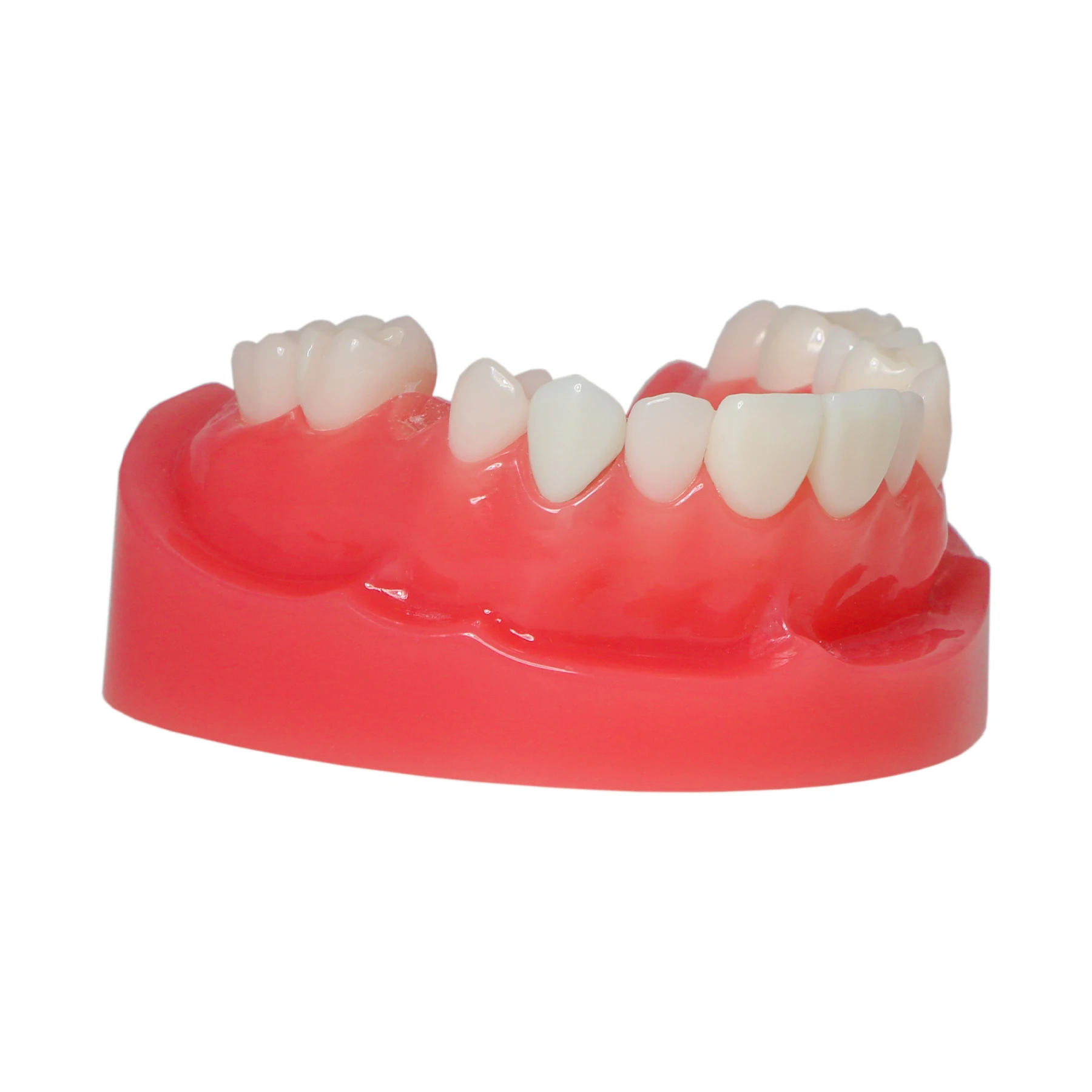 Afbeelding 3: M6024 Dental Post Core Bridge Overdenture Model Implantaatrestauratiemodel