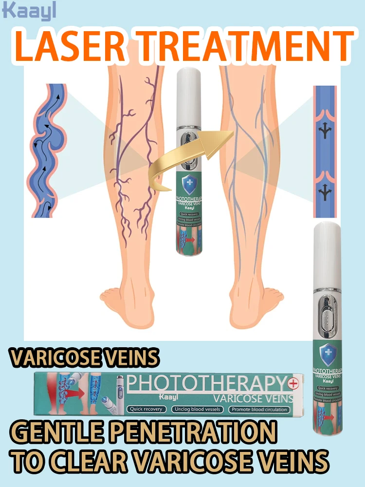 

Laser vein| Reduces Spider Veins and Heaviness| for Anyone with Sedentary or Standing