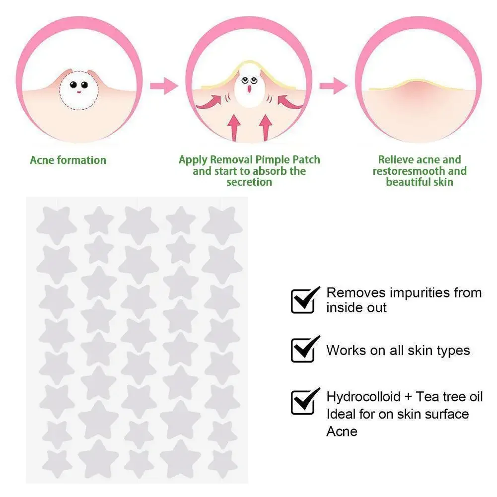 40pcs Star Shaped Acne Pimple Patch Invisible Concealer Waterproof Blemish Spot Pimple Treatment Face Beauty Skin Care