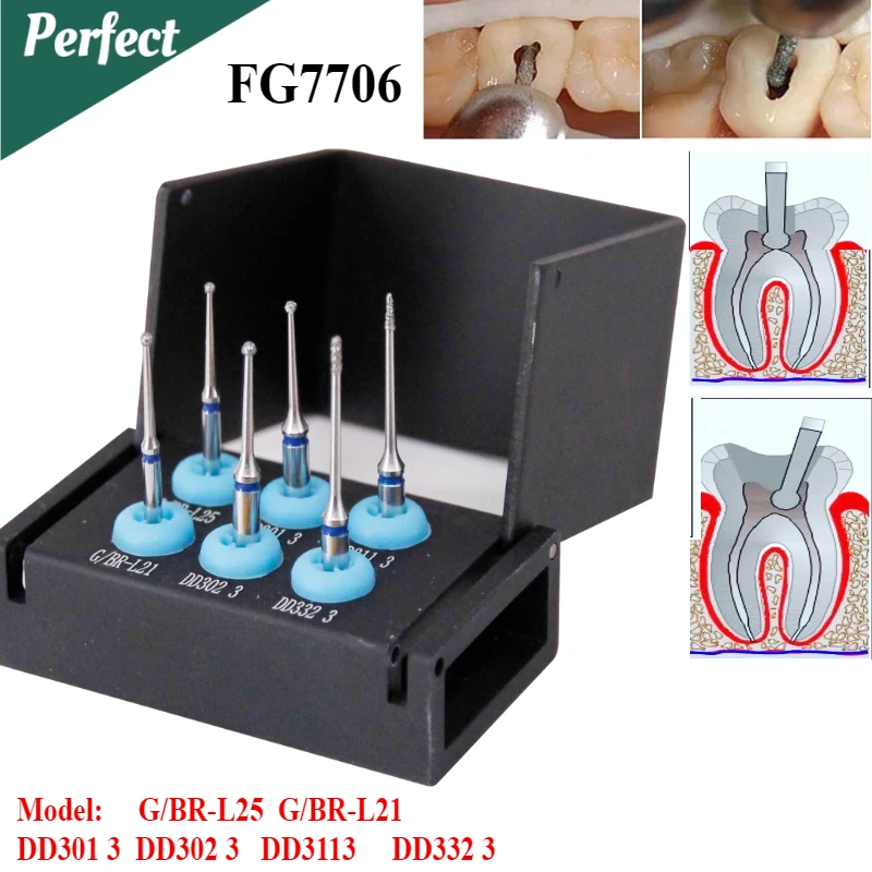 

Dental Open Pulp Cavity Burs Preparation Bur Kit Vital Pulp Cutting Bur Dental Pulpotomy Access