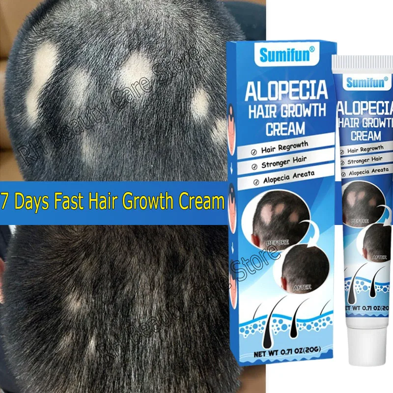 

Hair Growing Cream Prevent Alopecia Baldness Scalp hair follicle Regrowth Repair Ointment Treat Bald Grow Hair Root Nourish Care