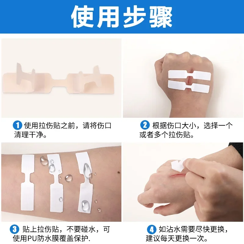 20pcs/set Emergency Wound Plasters Closures Mini Band Aid Repair Wound Without Stitches Plasters Adhesive Bandages Skin Patch