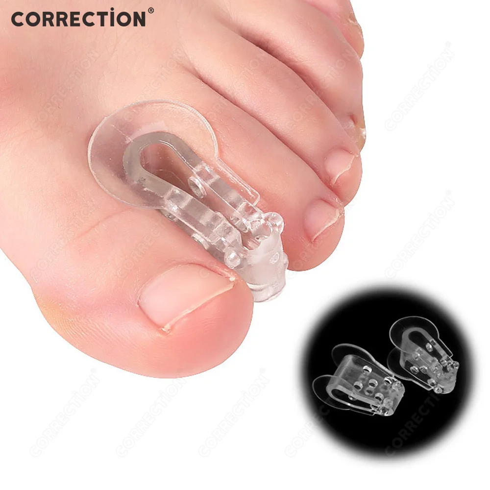 

CORRECTION Toe Separator Silicone Gel Bunion Corrector Hallux Valgus Spacer Straightener Alleviate Pain Safe Repeated Foot Care